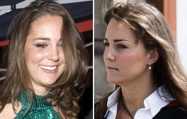 Kate Middleton Nose: Natural Feature or Rhinoplasty Speculation?